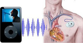 iPod безопасен для сердца — заявляет FDA